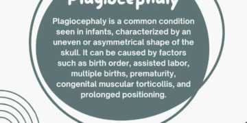 📣 Let's Discover the Two Types of Plagiocephaly! 🧒👶 